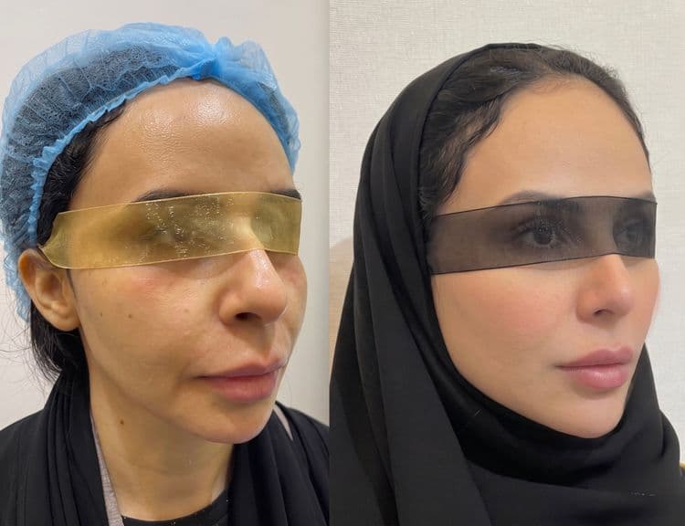 Face Harmonization (Case Study 2 Facial Harmonization)